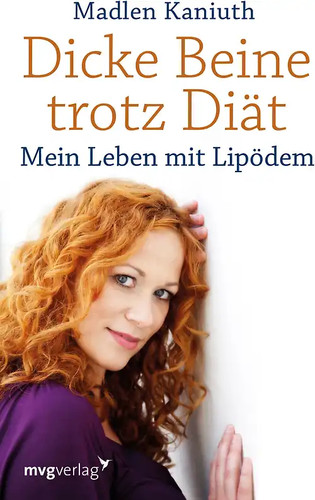 Dicke beine trotz diät - beine,